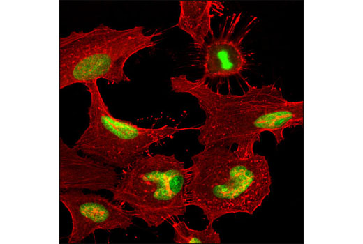 Confocal immunofluorescent analysis of HeLa cells using RCC1 (D15H6) Rabbit mAb (green). Actin filaments were labeled using DY-554 phalloidin (red).