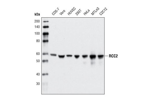 Western blot analysis of extracts from various cell types using RCC2 (D14F3) Rabbit mAb.