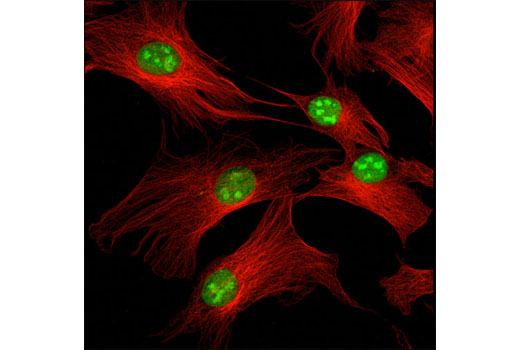 Confocal immunofluorescent analysis of HeLa cells using RCC2 (D14F3) Rabbit mAb (green) and α-Tubulin (DM1A) Mouse mAb #3873 (red).