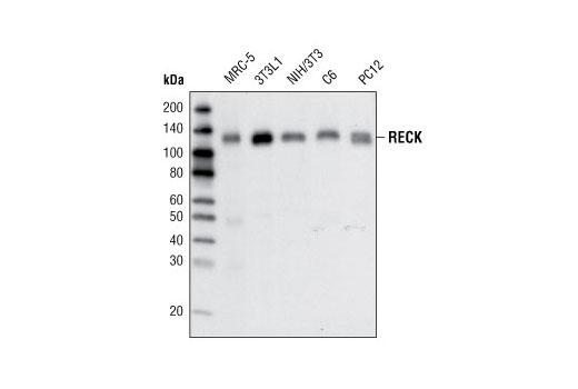 Western blot analysis of extracts from various cell lines using RECK (D8C7) Rabbit mAb.