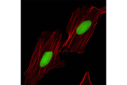 Confocal immunofluorescent analysis of HeLa cells using RecQL1 (Q1N3) Mouse mAb (green). Actin filaments were labeled with DY-554 phalloidin (red).