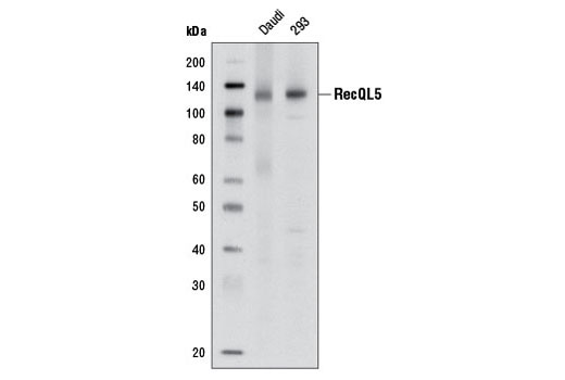 Western blot analysis of extracts from Daudi and 293 cells using RecQL5 (1A2) Mouse mAb.