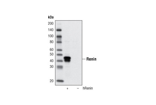 Western blot analysis of extracts from COS-7 cells, mock transfected or transfected with a construct expression human Renin, using Renin Antibody.