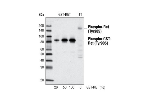 Western blot analysis of recombinant human GST-Ret (His658-Asp1110) and extracts from the TT human medullary thyroid carcinoma cell line using Phospho-Ret (Tyr905) Antibody.