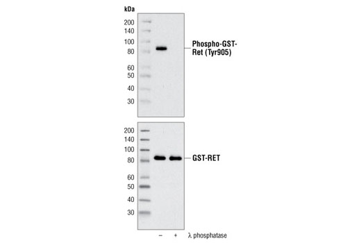 Western blot analysis of recombinant human GST-Ret (His658-Asp1110), untreated or λ phosphatase-treated, using Phospho-Ret (Tyr905) Antibody (upper) and Ret Antibody #3220 (lower).