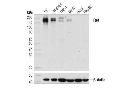 Western blot analysis of extracts from various cell lines using Ret (E1N9A) (Flow Preferred) Rabbit mAb (upper) and β-Actin (D6A8) Rabbit mAb #8457 (lower).