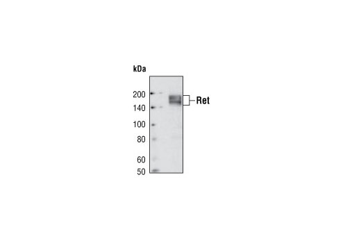 Western blot analysis of extracts from TT cells using Ret (C31B4) Rabbit mAb.