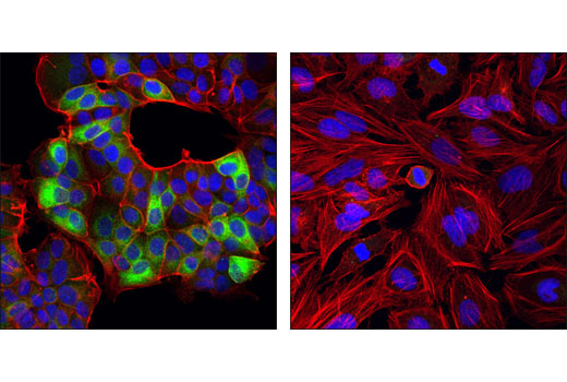 Confocal immunofluorescent analysis of MCF7 (left) and HeLa cells (right) using Ret (C31B4) Rabbit mAb (green). Actin filaments were labeled with DY-554 phalloidin (red). Blue pseudocolor = DRAQ5® #4084 (fluorescent DNA dye).