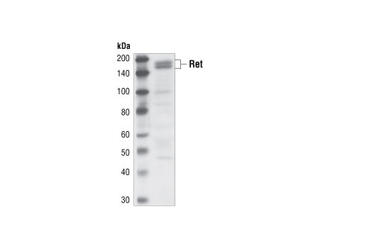 Western blot analysis of extracts from TT cells using Ret Antibody.