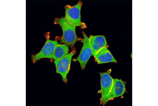 Confocal immunofluorescent analysis of MCF-7 cells using RhoGDI Antibody (green). Actin filaments were labeled with DyLight™ 554 Phalloidin #13054 (red). Blue pseudocolor = DRAQ5 ® #4084 (fluorescent DNA dye).