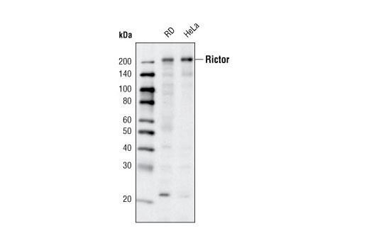 Western blot analysis of extracts from RD and HeLa cells using Rictor (D16H9) Rabbit mAb.