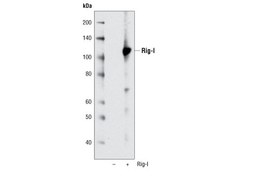 Western blot analysis of COS-7 cells, untransfected (-) or transfected (+) with human Rig-I, using Rig-I (D33H10) Rabbit mAb.