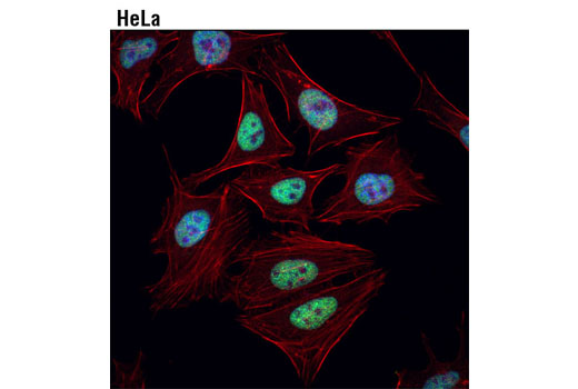 Confocal immunofluorescent analysis of HeLa cells using Ring1A (D2P4D) Rabbit mAb (green). Actin filaments were labeled with DyLight™ 554 Phalloidin #13054 (red). Blue pseudocolor = DRAQ5 ® #4084 (fluorescent DNA dye).