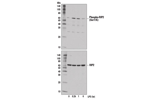 Western blot analysis of extracts from THP-1 cells, differentiated with TPA #4174 (80 nM, 24 hr) followed by treatment with LPS (1 μg/ml) for the indicated times, using Phospho-RIP2 (Ser176) (E1I9J) Rabbit mAb (upper) and RIP2 (D10B11) Rabbit mAb #4142 (lower).