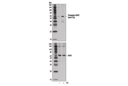 Western blot analysis of extracts from OVCAR8 cells, untreated (-) or UV-treated (+), using Phospho-RIP2 (Ser176) (E1I9J) Rabbit mAb (upper) and RIP2 (D10B11) Rabbit mAb #4142 (lower).