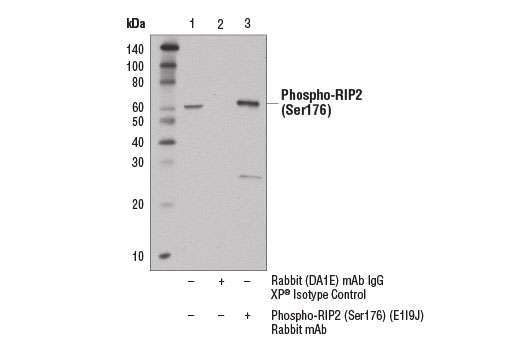 Immunoprecipitation of phospho-RIP2 (Ser176) from THP-1 cells, treated with TPA #4174 (80 nM, 24 hr) followed by LPS (1 μg/ml, 15 min), using Rabbit (DA1E) mAb IgG XP ® Isotype Control #3900 (lane 2) or Phospho-RIP2 (Ser176) (E1I9J) Rabbit mAb (lane 3). Lane 1 represents 10% input. Western blot was performed using Phospho-RIP2 (Ser176) (E1I9J) Rabbit mAb. Mouse Anti-rabbit IgG (Conformation Specific) (L27A9) mAb #3678 was used as a secondary antibody to avoid cross reactivity with rabbit IgG.