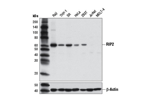 Western blot analysis of extracts from various cell lines using RIP2 (D10B11) Rabbit mAb (upper) or β-Actin (D6A8) Rabbit mAb #8457 (lower).
