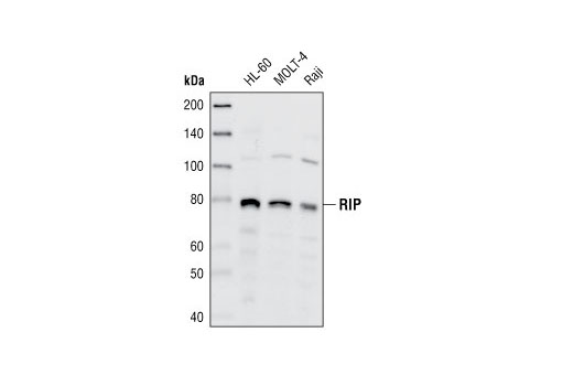 Western blot analysis of extracts from HL-60, MOLT-4 and Raji cell lines, using RIP Antibody.