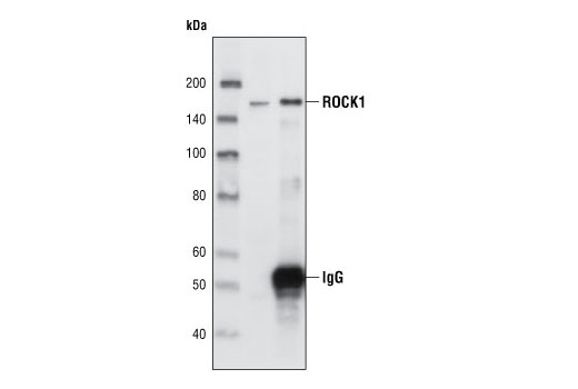 Immunoprecipitation of ROCK1 from HeLa cell extracts using ROCK1 (C8F7) Rabbit mAb. Western blot detection was perfomed using the same antibody. Lane 1 is 5% input.