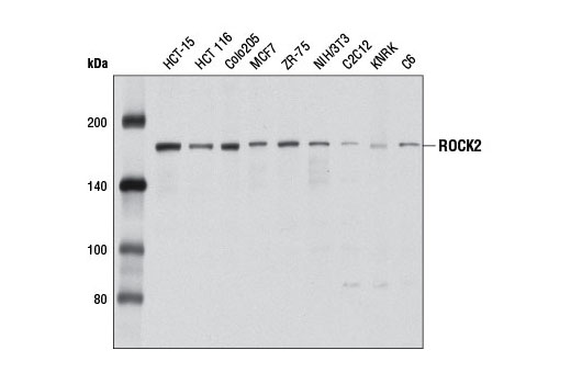 Western blot analysis of extracts from various cell lines using ROCK2 Antibody.