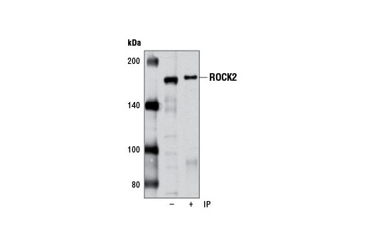 Immunoprecipitation of ROCK2 from HT-29 cells using ROCK2 Antibody. Western blot was performed using the same antibody. The (-) lane is 10% input.