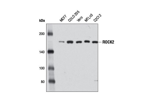 Western blot analysis of extracts from various cell lines using ROCK2 (D1B1) Rabbit mAb.