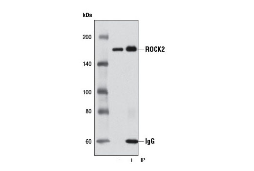 Immunoprecipitation of ROCK2 from HCT-15 cell extracts using ROCK2 (D1B1) Rabbit mAb (lane 2). Western blot was performed using the same antibody. Lane 1 is 10% input.