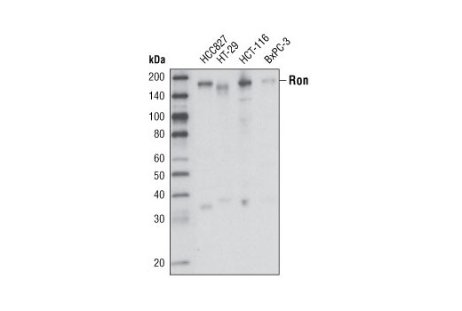 Western blot analysis of extracts from various cell types using Ron (1B5) Mouse mAb.
