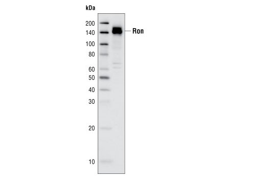 Western blot analysis of BxPC-3 cell extracts using Ron (C81H9) Rabbit mAb.