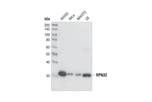 Western blot analysis of extracts from various cell lines, using RPA32 (4E4) Rat mAb.