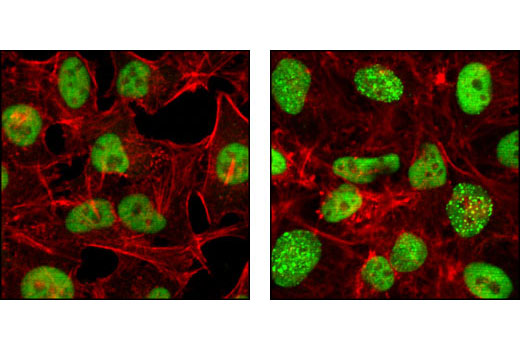 Confocal immunofluorescent analysis of HeLa cells, untreated (left) or UV-treated (right), using RPA32 (4E4) Rat mAb (green) showing translocation to distinct nuclear foci after UV damage. Actin filaments have been labeled with Alexa Fluor® 555 phalloidin. Blue pseudocolor = DRAQ5™ (fluorescent DNA dye).