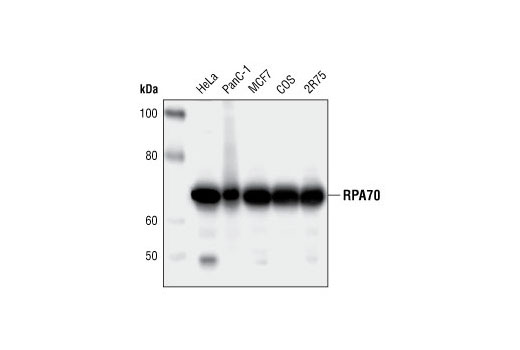 Western blot analysis of extracts from various cell lines, using RPA70 (4D9) Rat mAb.