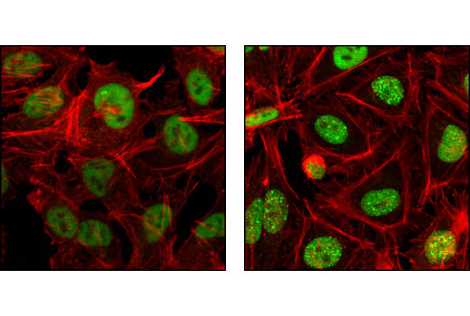 Confocal immunofluorescent analysis of HeLa cells, untreated (left) or UV-treated (right), using RPA70 (4D9) Rat mAb (green) showing translocation to distinct nuclear foci after UV damage. Actin filaments have been labeled with Alexa Fluor® 555 phalloidin. Blue pseudocolor = DRAQ5 ® #4084 (fluorescent DNA dye).