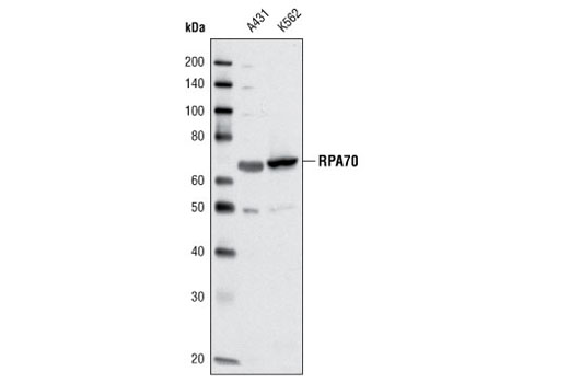 Western blot analysis of extracts from A431 and K562 cells using RPA70 (C24F2) Antibody.