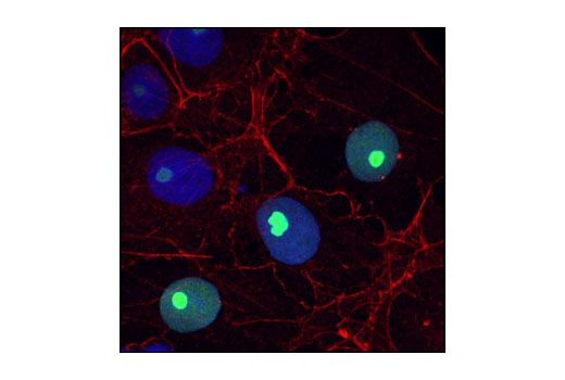 Confocal immunofluorescent analysis of COS cells using Ribosomal Protein L7a (E109) Antibody (green). Actin filaments have been labeled with Alexa Fluor ® phalloidin 555 (red). Blue pseudocolor = DRAQ5 ® #4084 (fluorescent DNA dye). Ribosomes are stained by the antibody at their biosynthesis site in nucleoli.