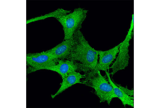 Confocal immunofluorescent analysis of C6 cells using Ribosomal Protein S3 (D50G7) XP ® Rabbit mAb (green). Blue pseudocolor = DRAQ5® #4084 (fluorescent DNA dye).