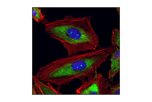 Confocal immunofluorescent analysis of HeLa cells using Ribosomal Protein S3 Antibody (green). Actin filamens have been labeled with Alexa Fluor ® 555 phalloidin (red). Blue pseudocolor = DRAQ5 ® #4084 (fluorescent DNA dye).