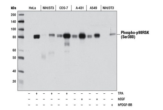 Western blot analysis of extracts from various cell lines, starved overnight and untreated (-) or treated with either TPA #4174 (200 nM, 15 min; +), hEGF #8916 (100 ng/ml, 15 min; +), or hPDGF-BB #8912 (100 ng/ml, 15 min; +), using Phospho-p90RSK (Ser380) (D5D8) Rabbit mAb.