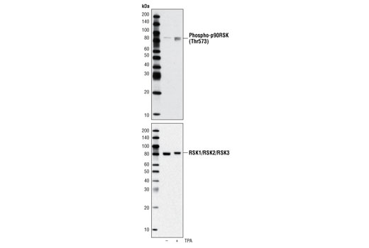Western blot analysis of extracts from HeLa cells, untreated or TPA-treated (200 nM), using Phospho-p90RSK (Thr573) Antibody (upper) or RSK1/RSK2/RSK3 (32D7) Rabbit mAb #9355 (lower).