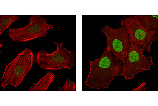 Confocal immunofluorescent analysis of HeLa cells, untreated (left) or TPA-treated (right), using Phospho-p90RSK (Thr573) Antibody (green). Actin filaments have been labeled with Alexa Fluor® 555 phalloidin (red).