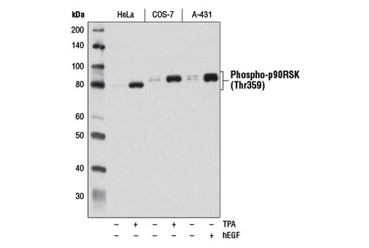 Western blot analysis of extracts from HeLa, COS-7, and A-431 cells, starved overnight and either untreated (-) or treated (+) with TPA #4174 (200 nM, 15 min) or Human Epidermal Growth Factor (hEGF) #8916 (100 ng/mL, 15 min), using Phospho-p90RSK (Thr359) (D1E9) Rabbit mAb.