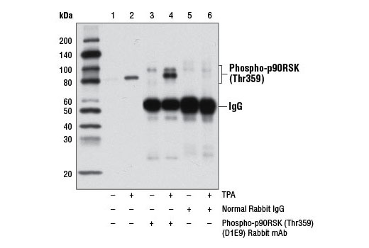 Immunoprecipitation of phospho-p90RSK (Thr359) from extracts of HeLa cells, serum starved overnight and either untreated (-) or treated with TPA #4174 (200 nM, 15 min; +), using Normal Rabbit IgG #2729 (lanes 5 and 6) or Phospho-p90RSK (Thr359) (D1E9) Rabbit mAb (lanes 3 and 4). Lanes 1 and 2 are 10% input. Western blot analysis was performed using RSK1/RSK2/RSK3 Antibody #9347.