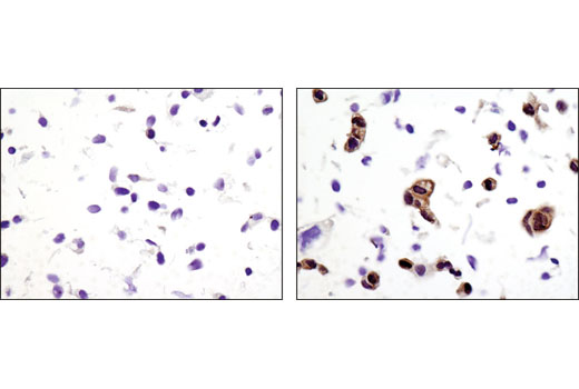 Immunohistochemical analysis of paraffin-embedded A-431 cell pellets, untreated (left) or treated with hEGF #8916 (right), using Phospho-p90RSK (Thr359) (D1E9) Rabbit mAb.