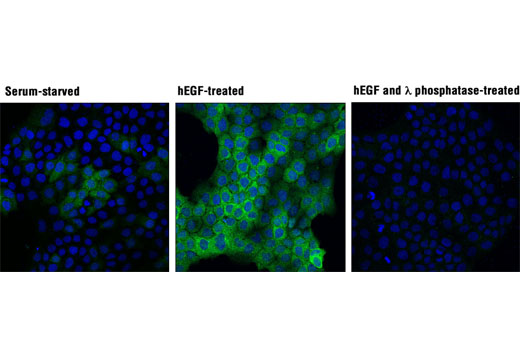 Confocal immunofluorescent analysis of A-431 cells, serum-starved (left), treated with hEGF #8916 (100 ng/mL, 15 min; center), or treated with hEGF and λ phosphatase (right), using Phospho-p90RSK (Thr359) (D1E9) Rabbit mAb (green). Blue pseudocolor = DRAQ5 ® #4084 (fluorescent DNA dye).