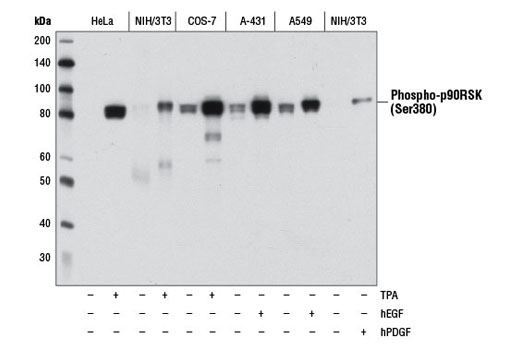 Western blot analysis of extracts from various cell lines, starved overnight and either untreated (-) or treated (+) with TPA #4174 (200 nM, 15 min), Human Epidermal Growth Factor (hEGF) #8916 (100 ng/mL, 15 min), or Human Platelet-Derived Growth Factor BB (hPDGF-BB) #8912 (100 ng/mL, 15 min) as indicated, using Phospho-p90RSK (Ser380) (D3H11) Rabbit mAb.