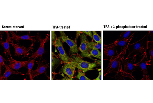 Confocal immunofluorescent analysis of NIH/3T3 cells, serum-starved (left), treated with TPA #4174 (200 nM, 15 min; center), or treated with TPA followed by λ phosphatase (right), using Phospho-p90RSK (Ser380) (D3H11) Rabbit mAb (green). Actin filaments were labeled with DY-554 phalloidin (red). Blue pseudocolor = DRAQ5 ® #4084 (fluorescent DNA dye).
