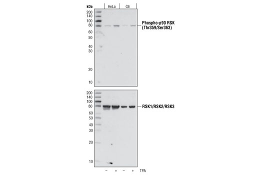 Western blot analysis of extracts from HeLa and C6 cells, untreated or TPA-treated (200 nM), using Phospho-p90RSK (Thr359/Ser363) Antibody (upper) or control RSK1/RSK2/RSK3 Rabbit mAb #9355 (lower).