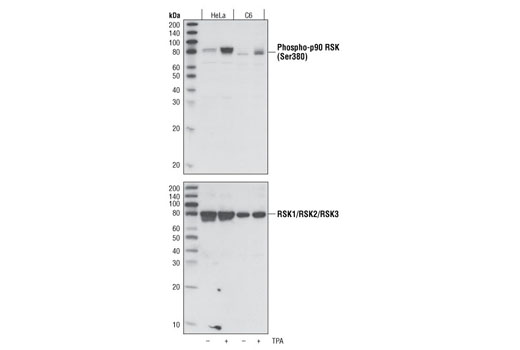 Western blot analysis of extracts from HeLa and C6 cells, untreated or TPA-treated (200 nM), using Phospho-p90RSK (Ser380) Antibody (upper) or control RSK1/RSK2/RSK3 Rabbit mAb #9355 (lower).