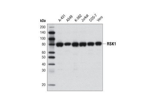 Western blot analysis of extracts from various cell lines using RSK1 (D6D5) Rabbit mAb.