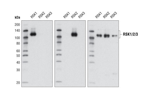 Western blot analysis of recombinant GST-tagged RSK1, RSK2, and RSK3 (2 μg each) using RSK1 (D6D5) Antibody #8408 (left panel), RSK2 (D21B2) Rabbit mAb #5528 (center panel) or GST Rabbit mAb #2625 (right panel).